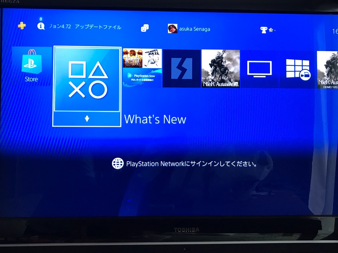 Psn 障害 画像