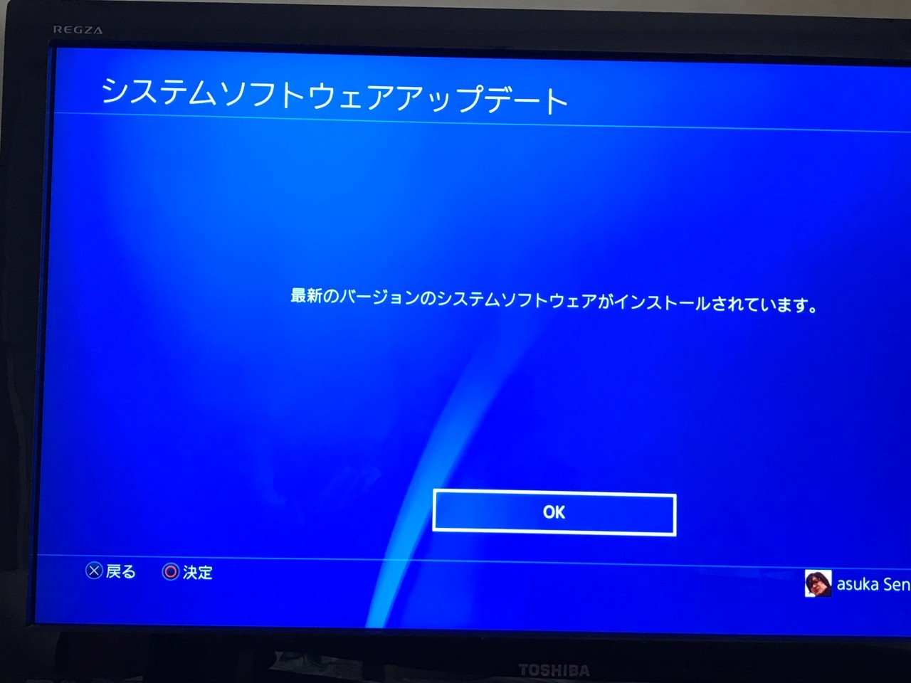 Psn 障害 画像